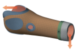 Italian researchers create lighter prosthetic sockets using field-driven lattice design