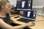 3D Printing Pilot in The Gambia Aims to Revolutionize Prosthetic Socket Production