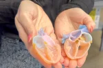 IU Health Opens 3D Print Studio for Patient-Specific Surgical Models